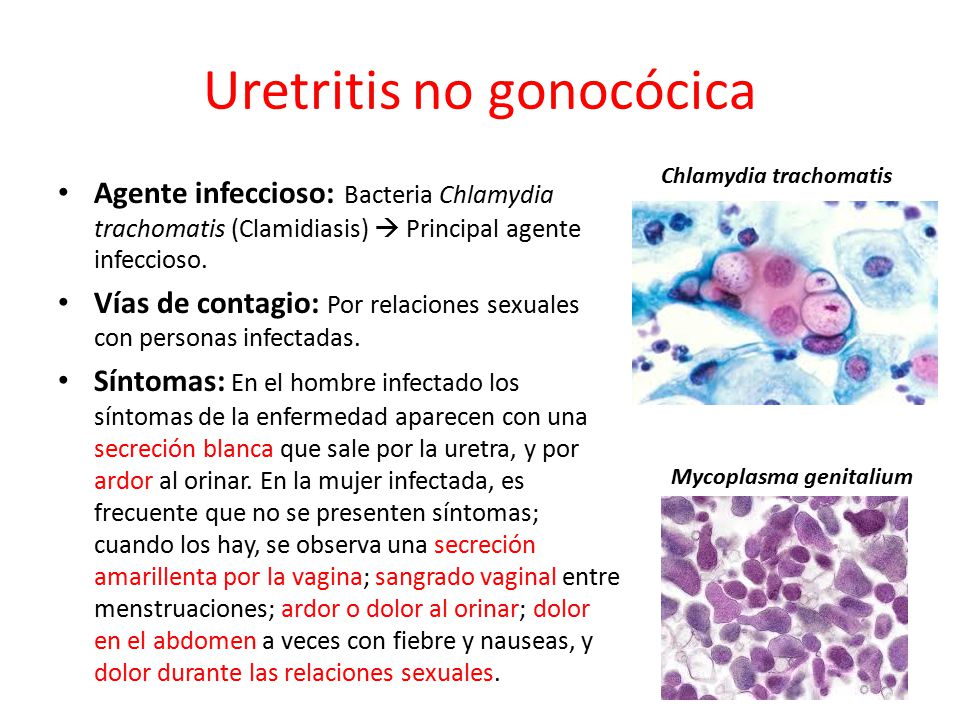 síntomas de uretritis hombre con